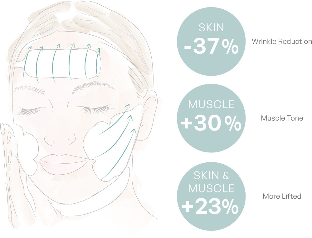 Sarasin Beauty HIEMT infographic