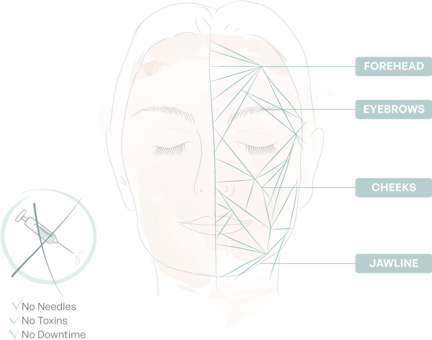 Sarasin Beauty HIEMT tekening zones